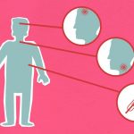 थायरॉइड के लक्षण: जो लापरवाही में ना गवाएं ध्यान